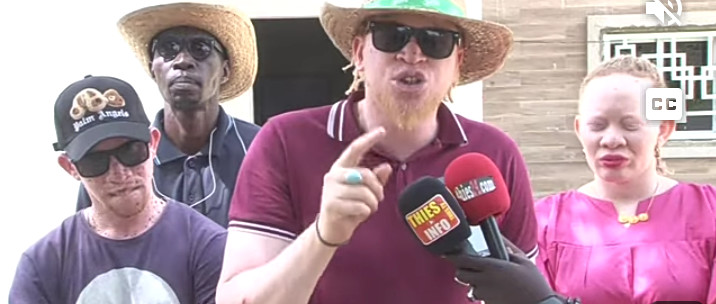 Thiès : Le vice président de l'association des Albinos lave à grande eau  leur président Bamba Diop