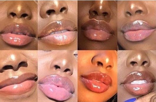 Le phénomène « risqué » des lèvres roses qui fait courir des jeunes africains… Le phénomène « risqué » des lèvres roses qui fait courir des jeunes africains…