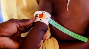 Diourbel : un cri d’alerte sur la malnutrition infantile et les lacunes du système de prise en charge Diourbel : un cri d’alerte sur la malnutrition infantile et les lacunes du système de prise en charge