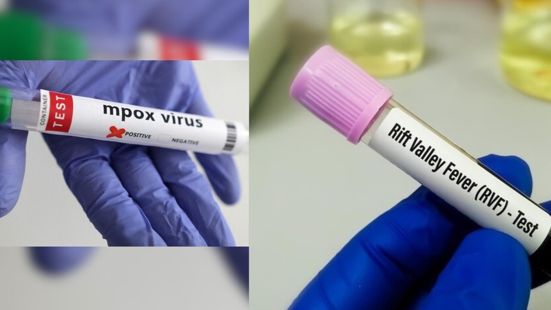 Sénégal : point sur la Mpox à Dakar et la Fièvre de la Vallée du Rift à Saint-Louis