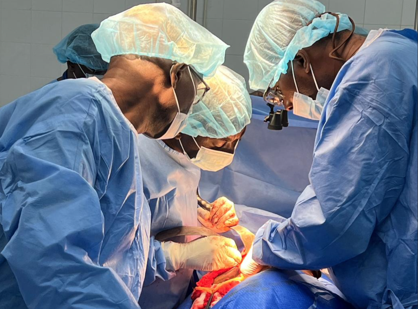 Succès de la Quatrième Transplantation Rénale à Dakar : Un Progrès Médical au Sénégal Succès de la Quatrième Transplantation Rénale à Dakar : Un Progrès Médical au Sénégal