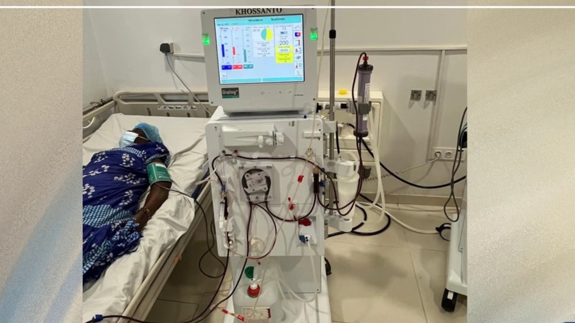 Kédougou : 24 patients sous dialyse, le centre hospitalier saturé