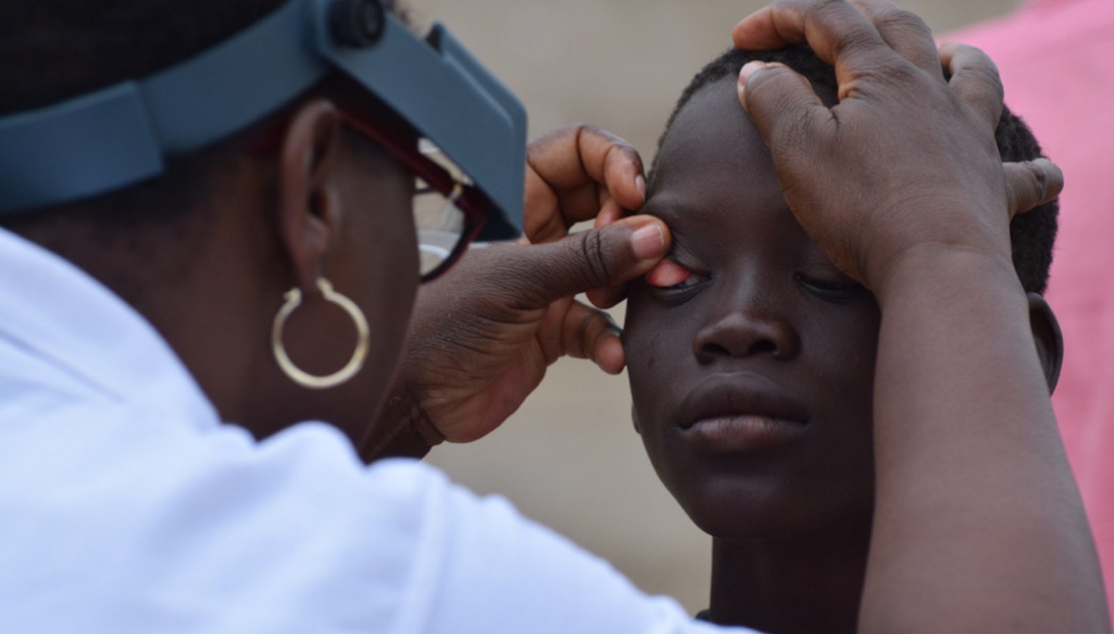 Le Sénégal élimine officiellement le trachome, selon l’OMS