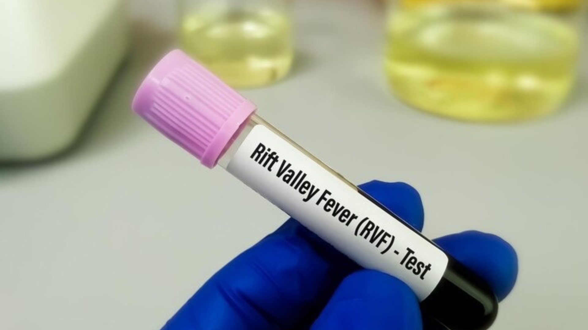 Fièvre de la vallée du Rift : 54 cas confirmés à Saint-Louis avec 8 décès