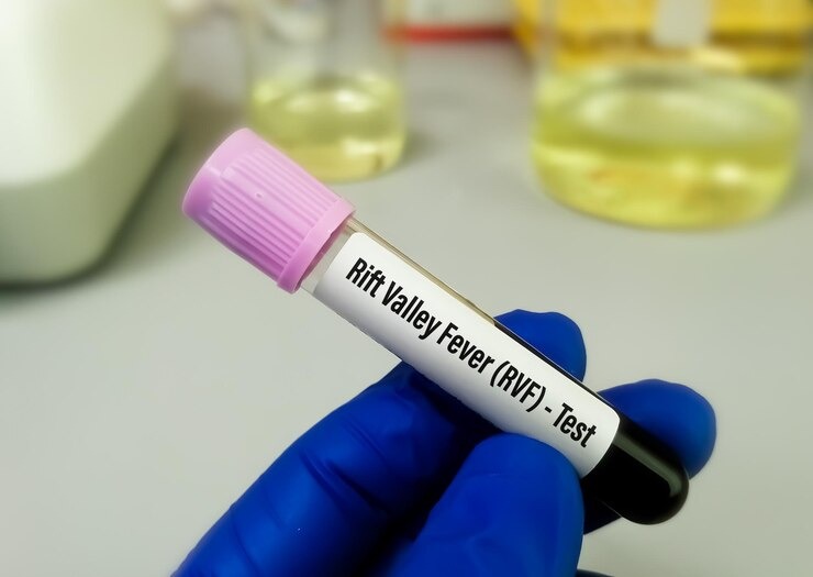 Mpox et Fièvre de la Vallée du Rift : Thiès enregistre son premier cas, 26 décès recensés au niveau national Mpox et Fièvre de la Vallée du Rift : Thiès enregistre son premier cas, 26 décès recensés au niveau national