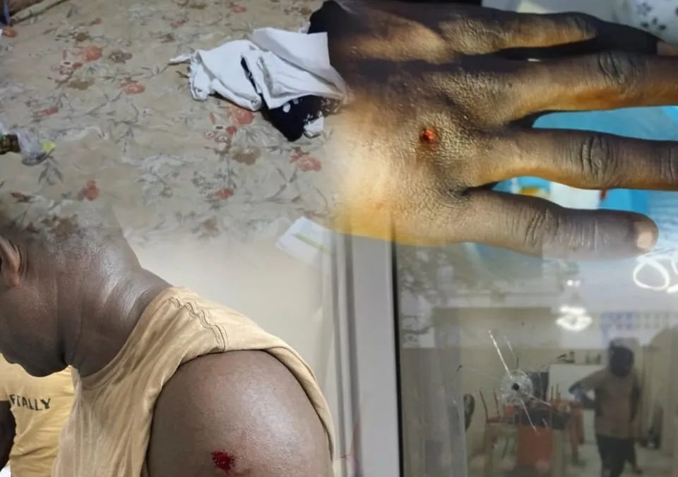 Dakar : un cambrioleur encagoulé à bord d’un 4x4 noir sème la panique à Liberté 6