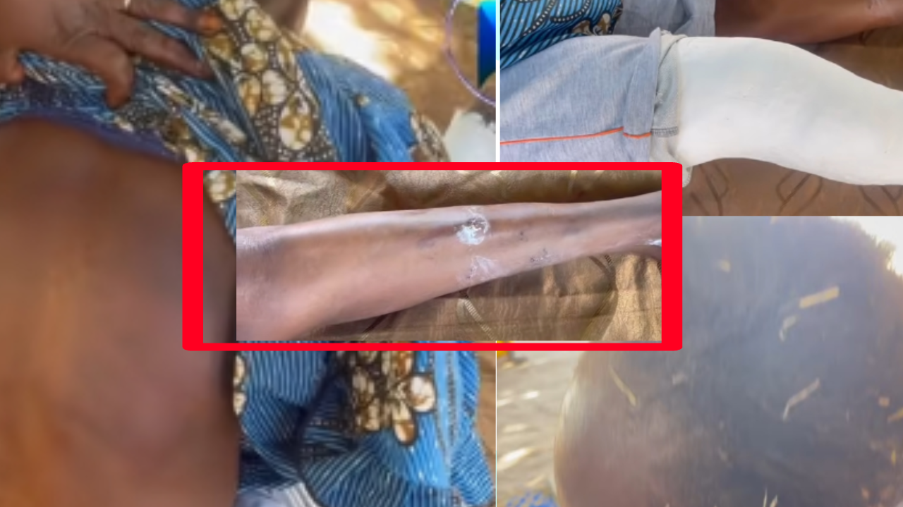 Mariage polygame et violences : une femme victime d’une attaque brutale à Thiès