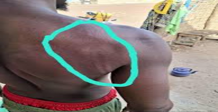 Diyabougou : un enseignant dénonce une violente agression par des hommes en tenue