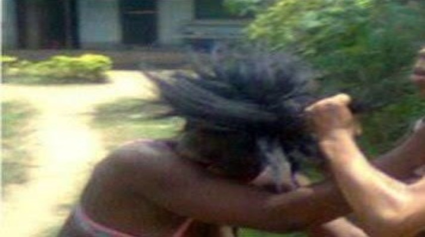 Mbour : répudiée, elle revient récupérer ses affaires et mord sa coépouse jusqu'à lui arracher une partie de la mâchoire Mbour : répudiée, elle revient récupérer ses affaires et mord sa coépouse jusqu'à lui arracher une partie de la mâchoire