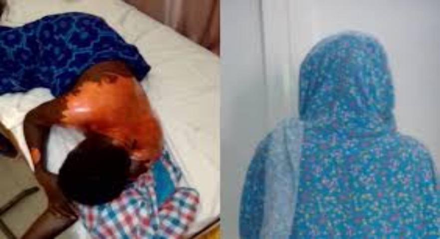 Kaolack : une femme hospitalisée après avoir reçu de l’huile bouillante de sa coépouse Kaolack : une femme hospitalisée après avoir reçu de l’huile bouillante de sa coépouse