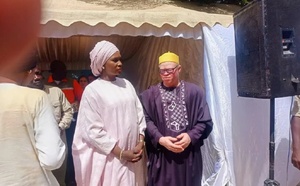 Journée mondiale de sensibilisation à l'albinisme : Les albinos du Sénégal relèvent des défis majeurs pour leur inclusion