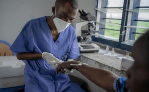 Mpox : le premier cas enregistré au Sénégal est officiellement guéri