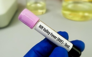 Fièvre de la vallée du Rift : 54 cas confirmés à Saint-Louis avec 8 décès