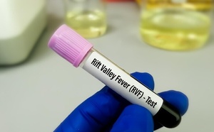 Mpox et Fièvre de la Vallée du Rift : Thiès enregistre son premier cas, 26 décès recensés au niveau national Mpox et Fièvre de la Vallée du Rift : Thiès enregistre son premier cas, 26 décès recensés au niveau national
