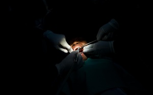 Pratiques dentaires non autorisées : l’Ordre des chirurgiens-dentistes interpelle les autorités