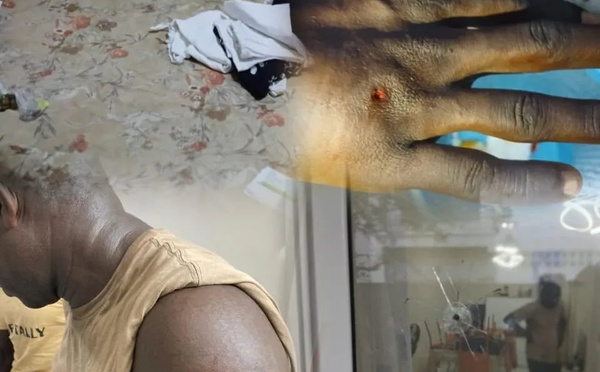 Dakar : un cambrioleur encagoulé à bord d’un 4x4 noir sème la panique à Liberté 6