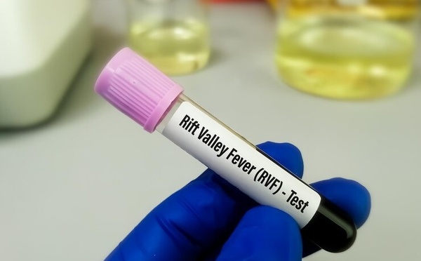 Fièvre de la vallée du Rift : la situation s’améliore selon l’ISRA