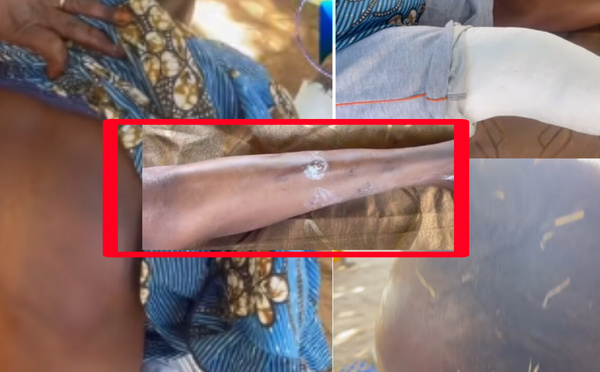 Mariage polygame et violences : une femme victime d’une attaque brutale à Thiès