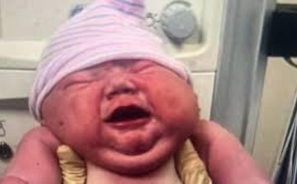 États-Unis : une Américaine donne naissance à un bébé géant de près de 6 kg