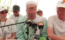Journée des Albinos à Thiès : Le PCA de l'association annonce une plainte contre Ahmadou Bamba Diop