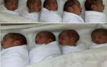Cameroun : Après 14 ans de relation, un couple Nigerian a donné naissance à 9 bébés