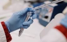 Un cas  de la fièvre hémorragique Crimée - Congo découvert à Bokidiawé Un cas  de la fièvre hémorragique Crimée - Congo découvert à Bokidiawé