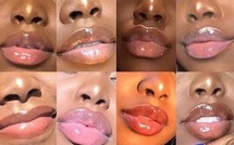 Le phénomène « risqué » des lèvres roses qui fait courir des jeunes africains…