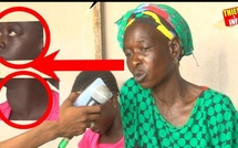 Elle raconte la maladie de sa fille agée de 15 ans et verse de chaudes larmes Elle raconte la maladie de sa fille agée de 15 ans et verse de chaudes larmes