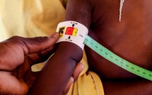 Malnutrition infantile : 1000 cas pris en charge à Diourbel en 2024 selon les autorités sanitaires Malnutrition infantile : 1000 cas pris en charge à Diourbel en 2024 selon les autorités sanitaires