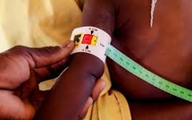 Diourbel : un cri d’alerte sur la malnutrition infantile et les lacunes du système de prise en charge