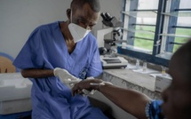 Mpox : le premier cas enregistré au Sénégal est officiellement guéri
