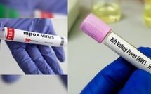 Sénégal : point sur la Mpox à Dakar et la Fièvre de la Vallée du Rift à Saint-Louis