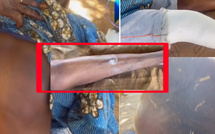 Mariage polygame et violences : une femme victime d’une attaque brutale à Thiès